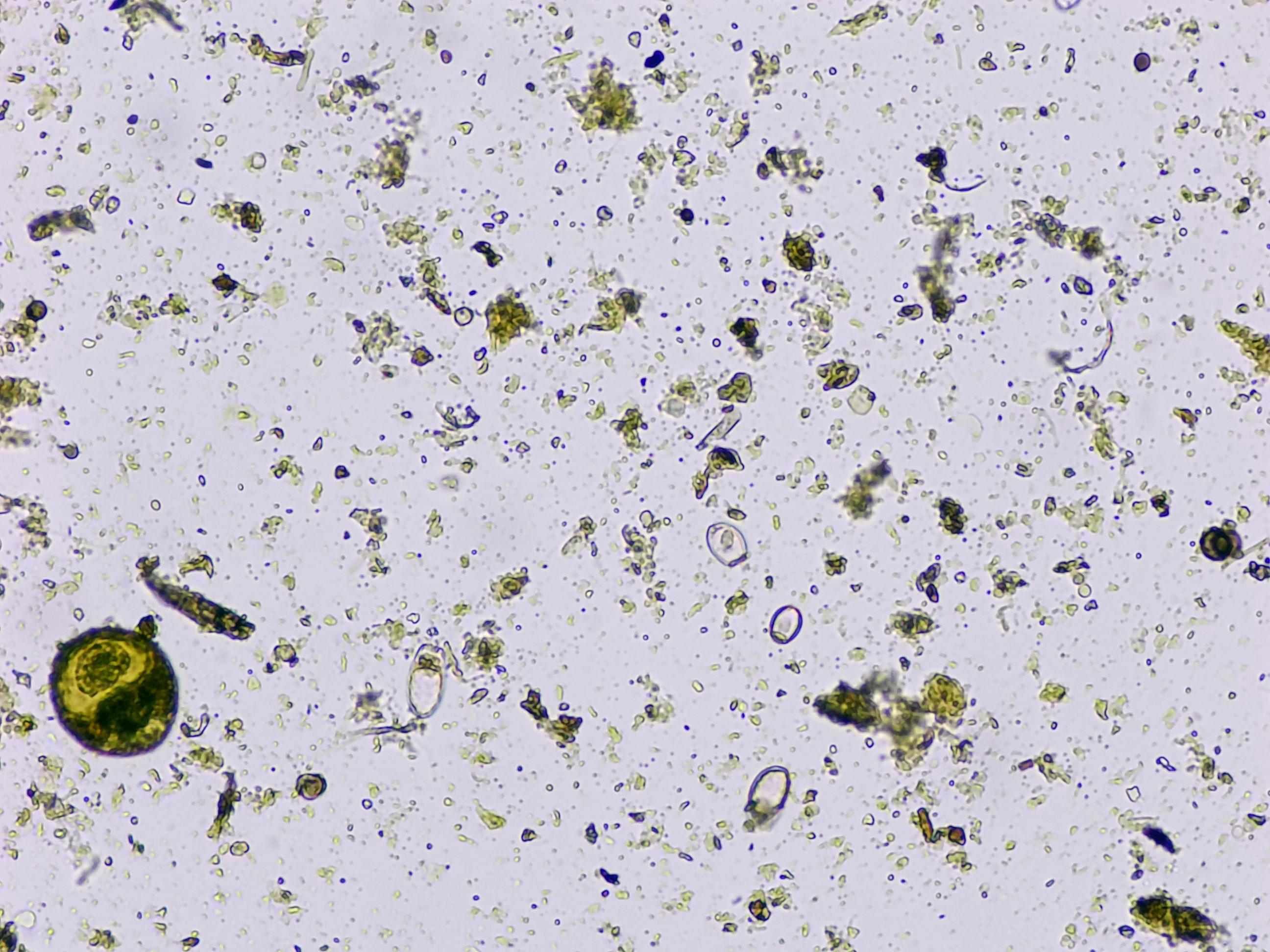 Microscope image 1